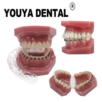 Стоматологичен Невидим скоба Ортодонтическая модел за практикуване на зъбен техника, обучение, комуникация с пациента Модел на зъбите